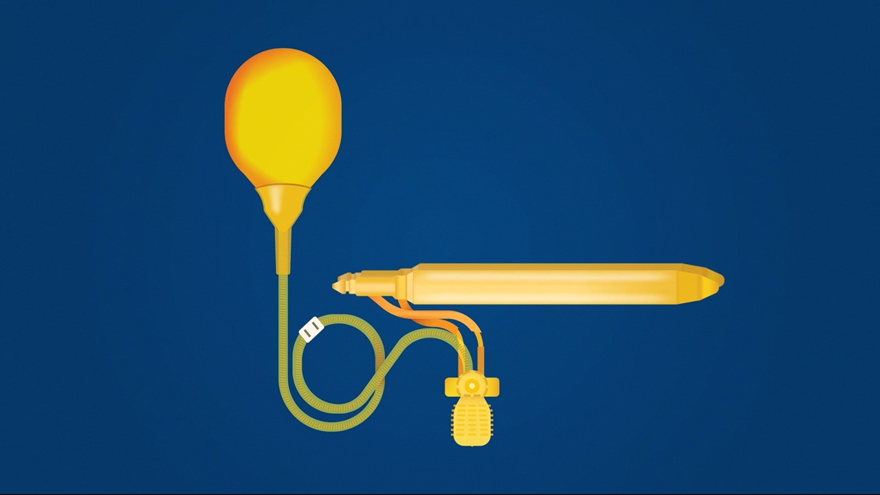 Vertrauen zurückgewinnen mit dem AMS 700™ Penisimplantat