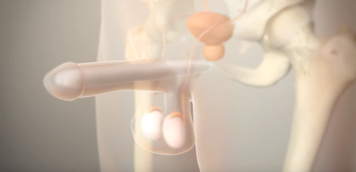 Tactra penile implantatie video animatie.